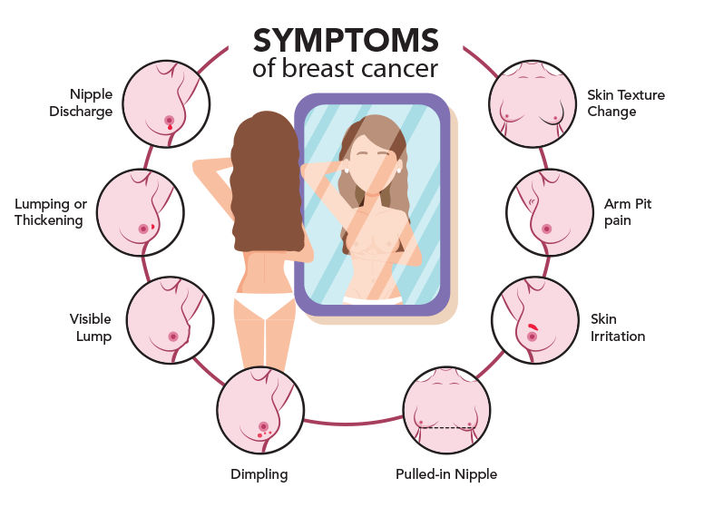 What are the signs and symptoms of breast cancer