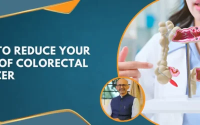 Tips To Reduce Your Risk Of Colorectal Cancer
