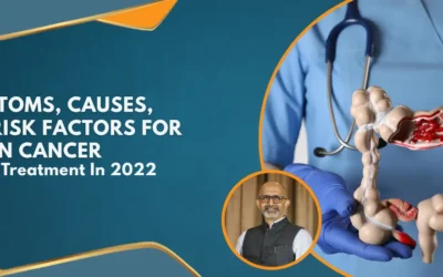 Symptoms, Causes, And Risk Factors For Colon Cancer And Its Treatment In 2022
