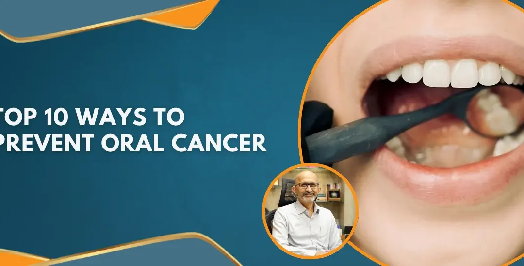 Top Ways To Prevent Oral Cancer