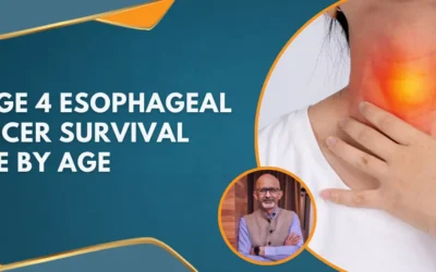 Stage 4 esophageal cancer survival rate by age