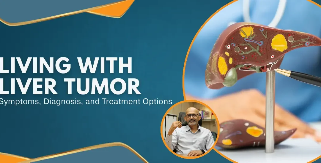 Living With Liver TumorS ymptoms DiagnosisandTreatmentOptions