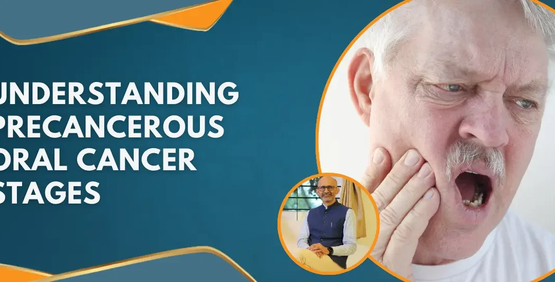 UnderstandingPrecancerousOralCancerStages