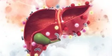 Liver cancer