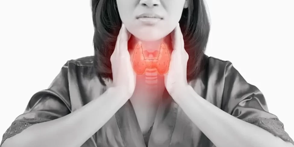 Robotic Thyroidectomy: New Treatment for Thyroid Cancer