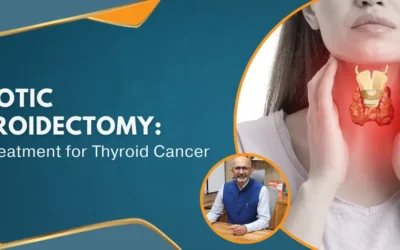 Robotic Thyroidectomy: New Treatment for Thyroid Cancer