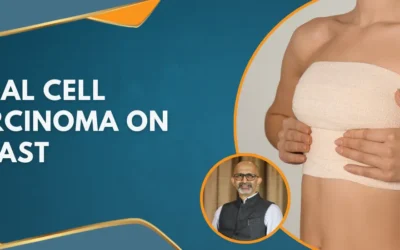 Basal Cell Carcinoma on Breast