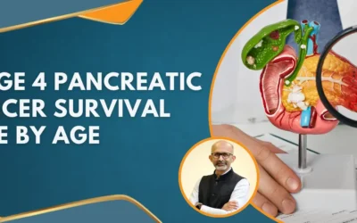 Stage 4 Pancreatic Cancer Survival Rate By Age