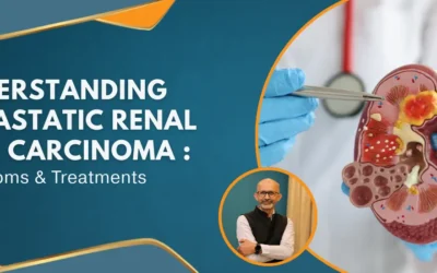 Understanding Metastatic Renal Cell Carcinoma: Symptoms & Treatments