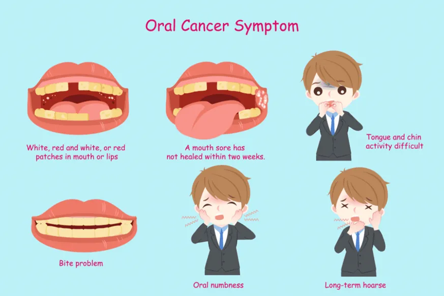 ORAL CANCER SYMPTOMS