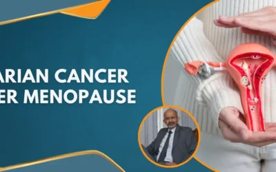 Ovarian Cancer After Menopause
