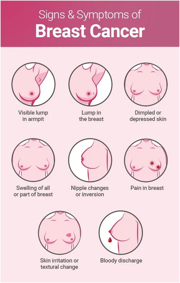 Symptoms of breast cancer