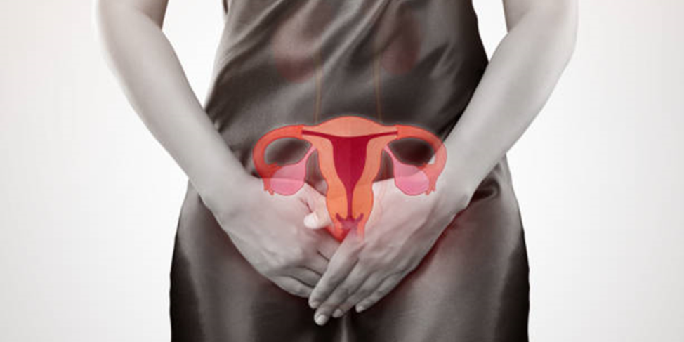 Ovarian Cancer Genetic