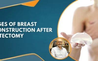 Stages Of Breast Reconstruction After Mastectomy