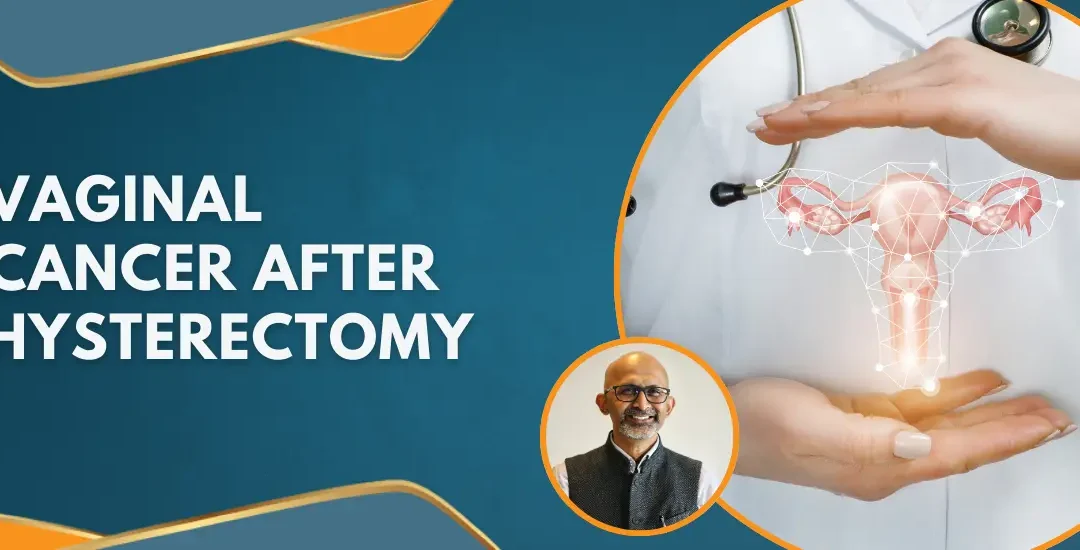 Vaginal Cancer after Hysterectomy