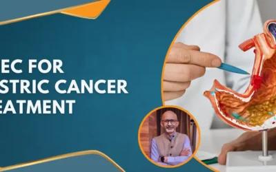 HIPEC for Gastric Cancer Treatment