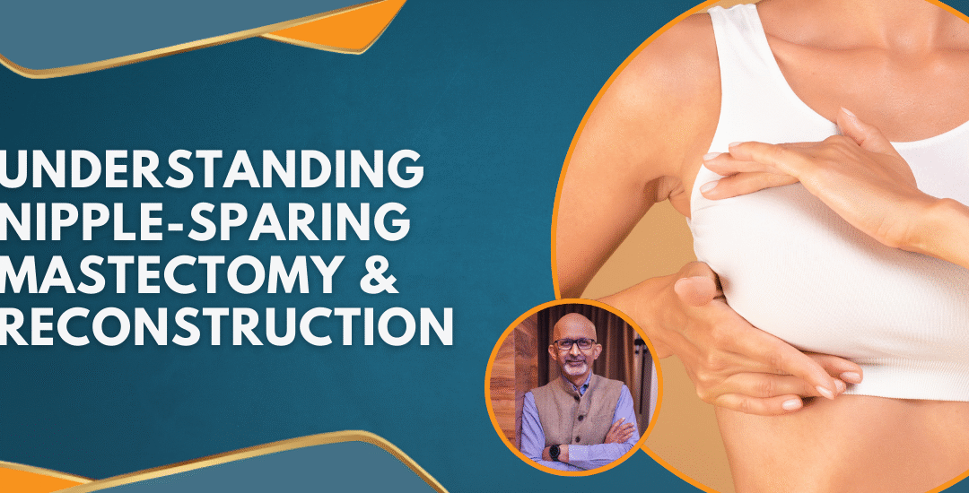 UnderstandingNipple-SparingMastectomyReconstruction