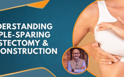Understanding Nipple-Sparing Mastectomy & Reconstruction