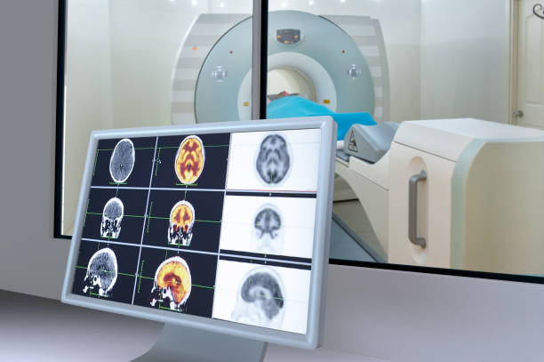 PET CT Can Diagnose Cancer – Myth or Fact?