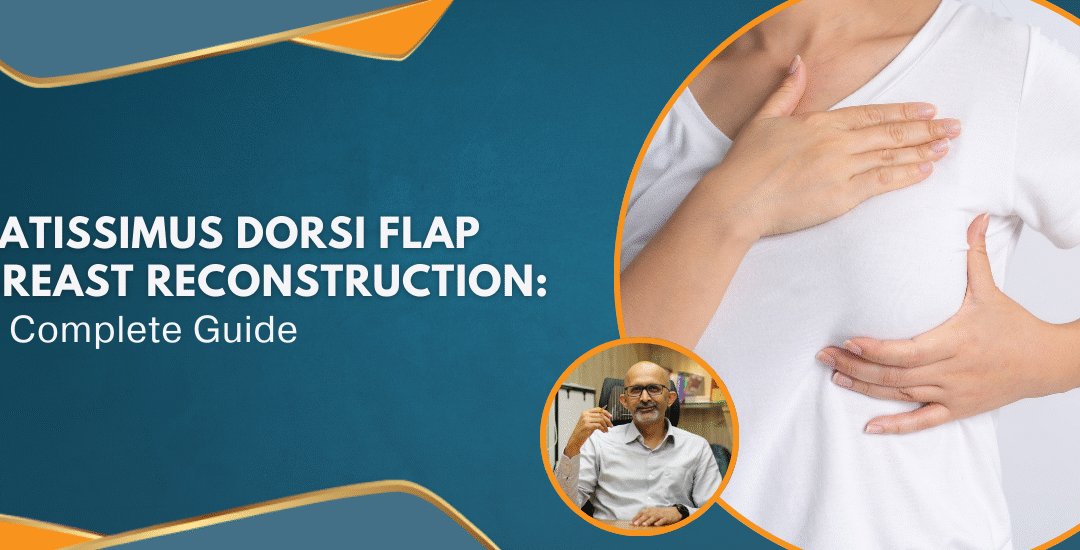 Latissimus Dorsi Flap Breast Reconstruction: A Complete Guide