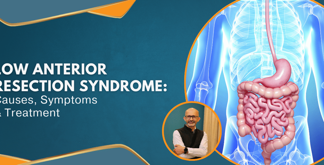 LowAnteriorResectionSyndrome