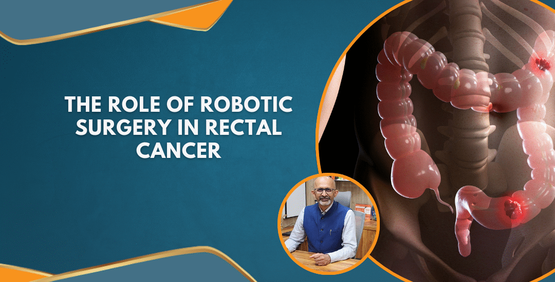 The Role of Robotic Surgery in Rectal Cancer: Insights from India’s Largest Multicenter Study