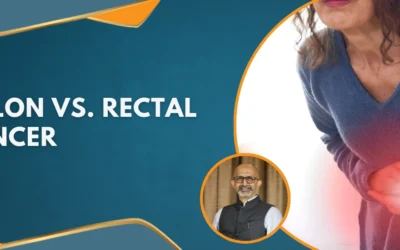 Colon vs. Rectal Cancer: Understanding the Key Differences