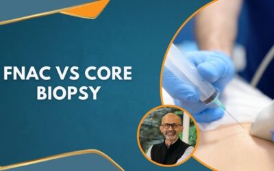 FNAC vs Core Biopsy: Understanding the Difference in Cancer Diagnosis
