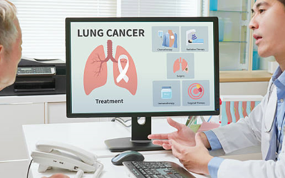 Radiotherapy for Lung Cancer: A Vital Treatment Option