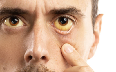 10 Warning Signs of Liver Disease You Should Never Ignore