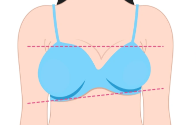 What Color Is Breast Cancer Discharge? Signs & Warning Symptoms