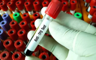 Does High TPO Antibodies Mean Cancer