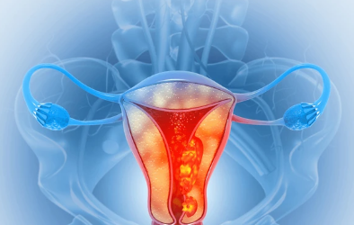  Is Uterine Cancer Curable