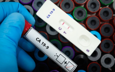  CA 19-9 Levels That Indicate Cancer