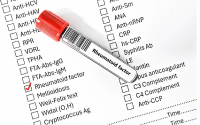 What Cancer Causes High Rheumatoid Factor?