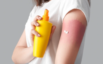 Does Sunscreen Cause Skin Cancer?