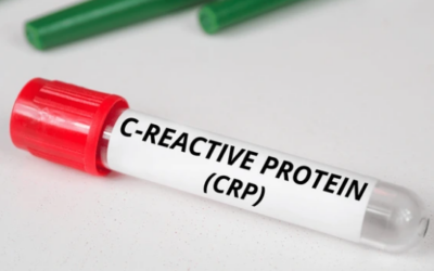 What CRP Level Indicates Cancer?