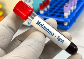  Does High MCV Mean Cancer?