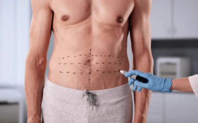 Cancers That Cause Fluid in the Abdomen