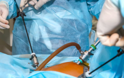Benefits of Laparoscopic Cancer Surgery