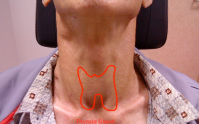 Best Hospital for Thyroid Cancer Treatment Bangalore?