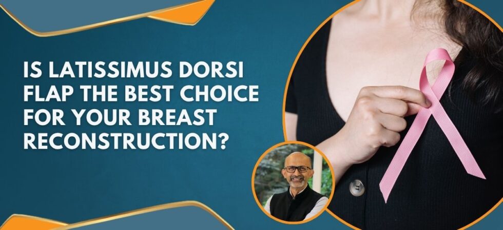 LD Flap for Breast Reconstruction | Dr. Sandeep Nayak