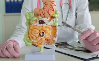  Long-Term Side Effects of Colon Resection