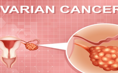 Can Ovarian Cysts Cause Cancer?