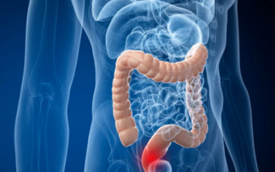 What Cancers Does Dr. Sandeep Nayak Treat at MACS Clinic?