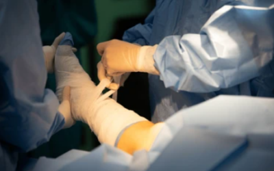 What Is Robotic Cancer Surgery?