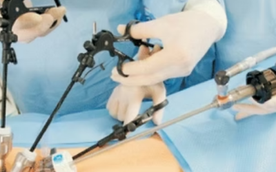 What Is Scarless Cancer Surgery?