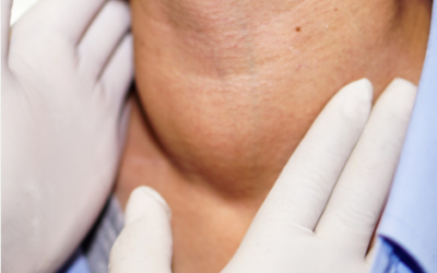 Who Performs Scarless Thyroid Surgery in Bangalore?