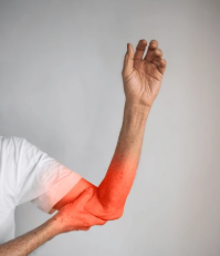 Is Right Arm Pain a Symptom of Cancer?