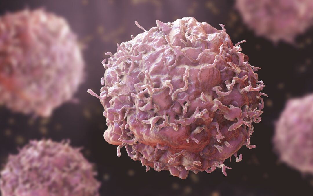 Cancer Second Opinion Before Surgery vs Trusting First Diagnosis